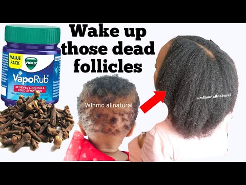 MIX VICKS VAPOUR RUB & CLOVES! How to use vicks & cloves for super fast hair growth!Wlhmc allnatural