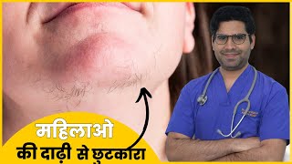HIRSUTISM | महिलाओं की दाढ़ी मूछ क्यों आ जाती है | कारण और  इलाज |