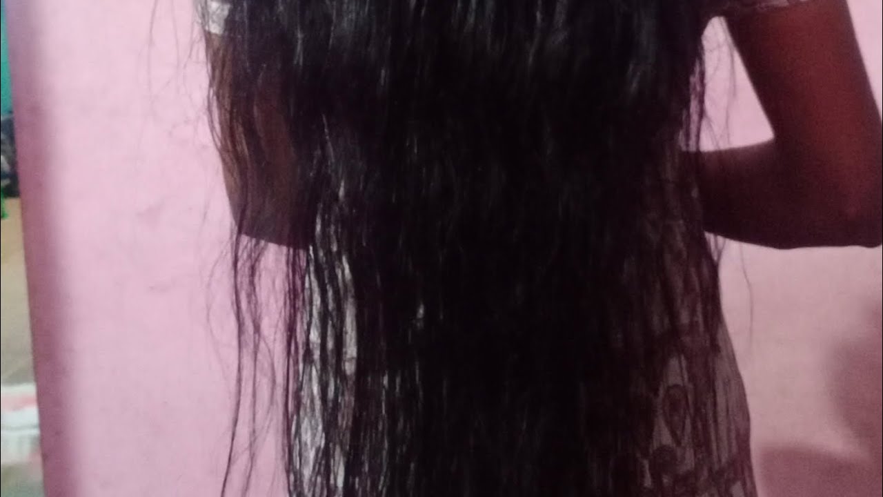 മുടികൊഴിച്ചിൽ മാറ്റിയെടുത്താലോ 