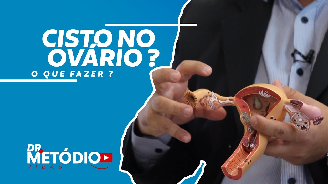 Cisto no ovário O que é