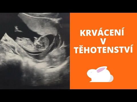 Video: Známky Tehotenstva S Chlapcom