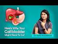 Gallstones Symptoms and Treatment | Do You Need gallbladder surgery? | Dr Nidhi Khandelwal