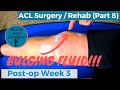 Week 3 Post-surgery... Physical Therapy at Home // ACL Surgery Vlog (Part 8)