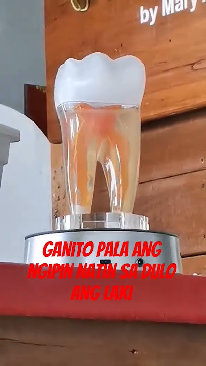 #trending #the teeth#is big#shortvedio #ytshorts #viral #