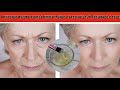 ANTI- RUGAS NATURAL COMO ELIMINAR RUGAS DA TESTA E ROSTO USE 2X RESULTADO E ESSE!