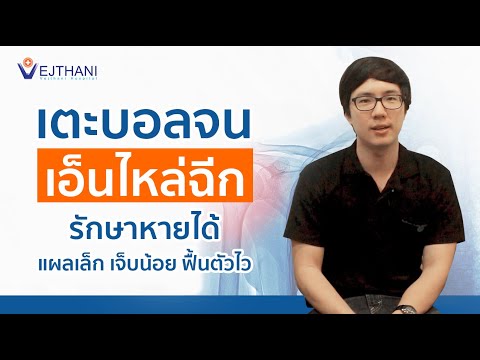 เตะบอลจนเอ็นไหล่ฉีก รักษาหายได้ (แผลเล็ก เจ็บน้อย ฟื้นตัวไว) l โรงพยาบาล เวชธานี