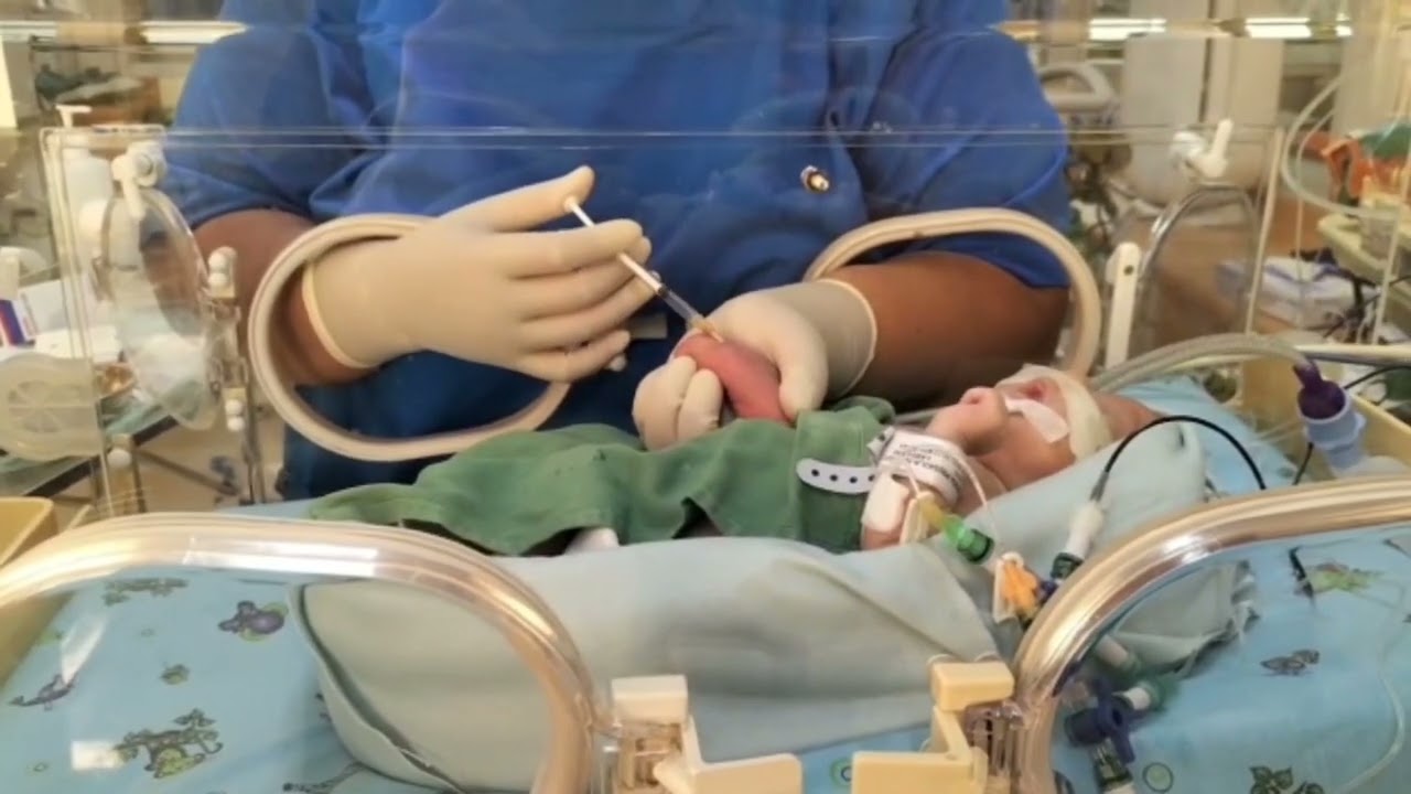 PEMASANGAN INFUS PADA NEONATUS // Sarifah Siti Hajjahrina // RSCM // PERAWAT PERINA //