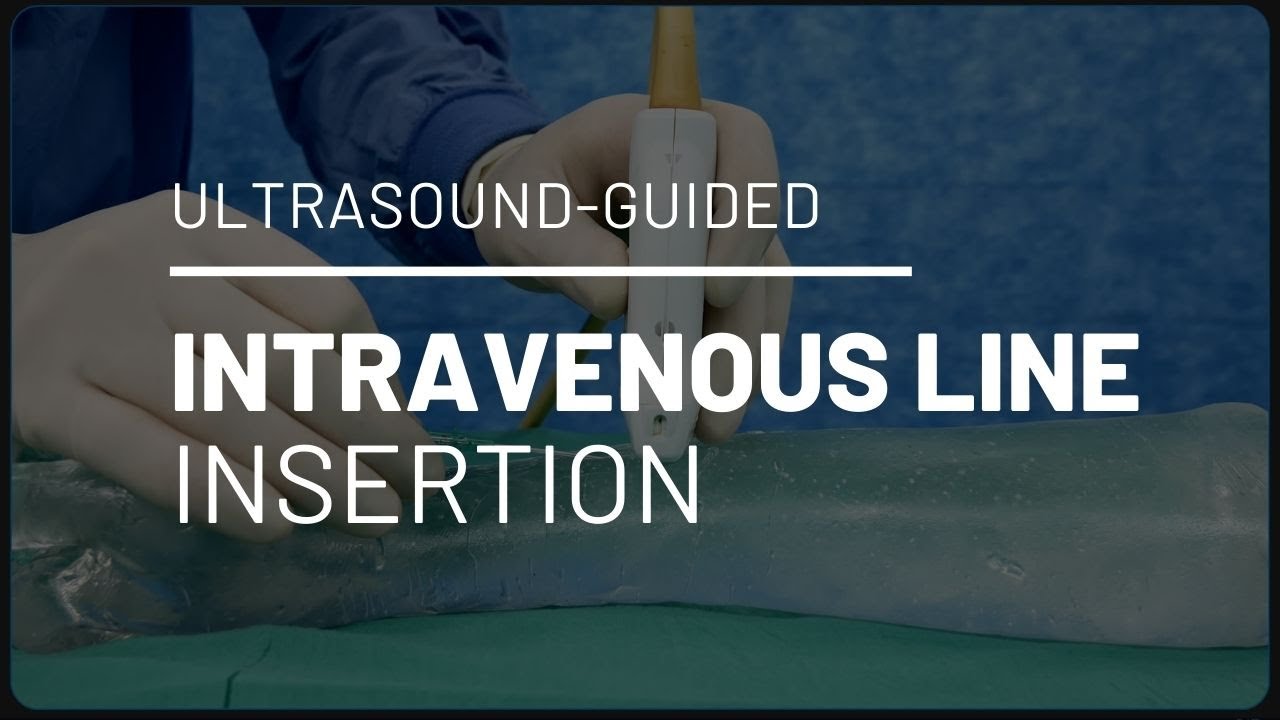 Ultrasound Guided Intravenous Line IV Insertion Out of Plane Bevel Ultrasound Guided Intravenous Line IV Insertion Out of Plane Bevel