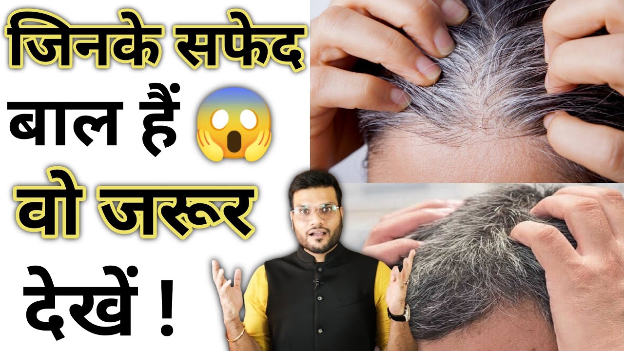 जिनके सफेद बाल हैं वो जरूर देखें | Arvind Arora | #a2sir #a2motivation ...