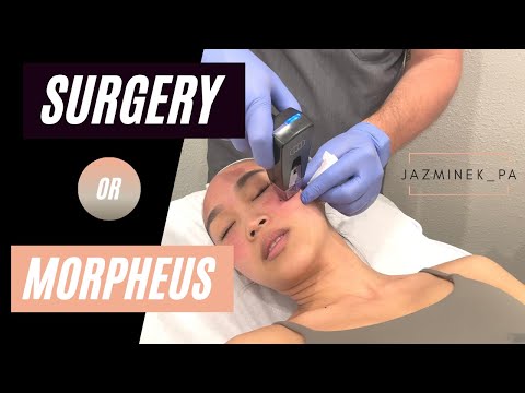 Download MORPHEUS 8 Procedure Experience