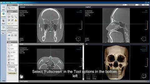 Xelis Dental Capture