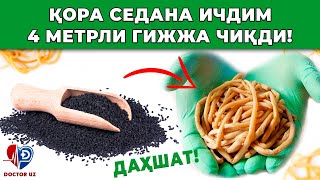 ҚОРА СЕДАНА ИЧДИМ ИЧИМДАН 4 МЕТРЛИ ГАЖЖА ЧИҚДИ! ШИФОКОРЛАР ШОКДА!