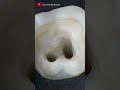 Accessing The Root Canals #teeths