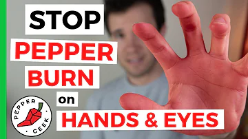 How do you neutralize chili burn on your hands?