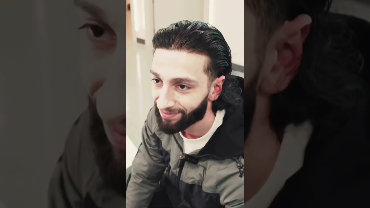 3 ans après sa greffe, Ali Yildiz revient nous voir : un résultat impeccable, signé Bella Hair ✍️