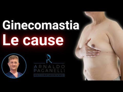 GINECOMASTIA: Cos’è -  Le cause