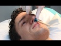 Nose Hair Waxing