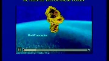 AIOC2018 - IC532 - Topic - Botulinum Toxin: Introduction and reconstitution - Dr.Vidhya N