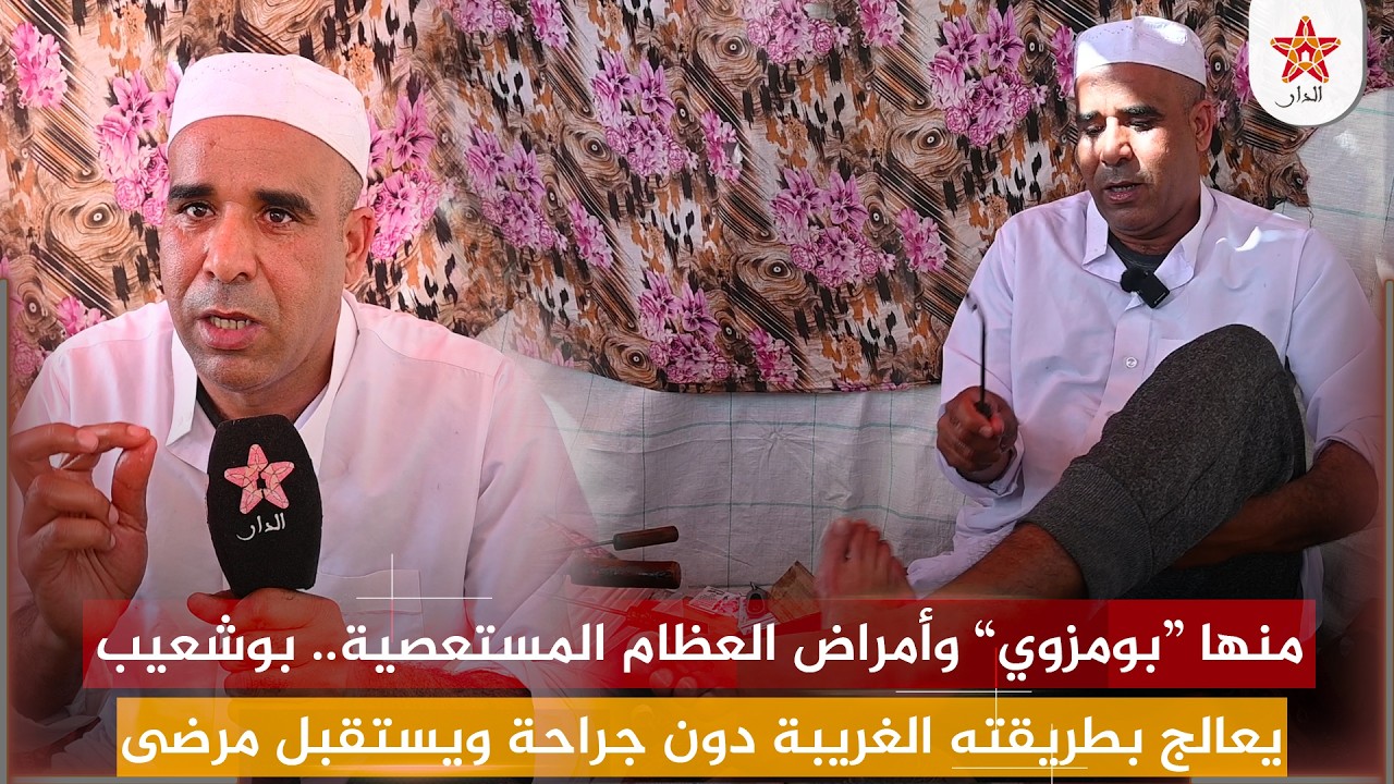 منها “بومزوي” وأمراض العظام المستعصية.. بوشعيب يعالج بطريقته الغريبة دون جراحة ويستقبل مرضى