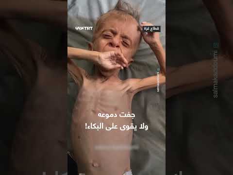 جفاف الدموع: معاناة إنسانية مؤثرة.