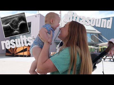 Receiving AMAZING NEWS From The Doctor!!! *Ultrasound Results*