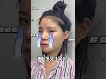 In order to become beautiful, she used her husband's money to have plastic surgery #整形