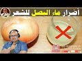 ها علاش ماء البصل خطير على الشعر الدكتور عماد ميزاب 