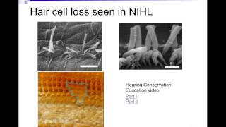 CDIS 4027 Disorders of the Inner Ear