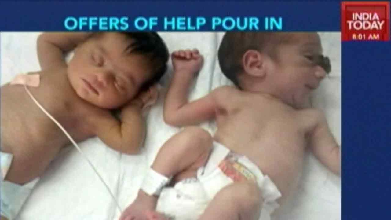 Offers Of Help Pour In For Abandoned 'Special' Babies In Kashmir YouTube