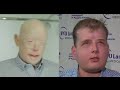 Burned Firefighter Receives Face Transplant