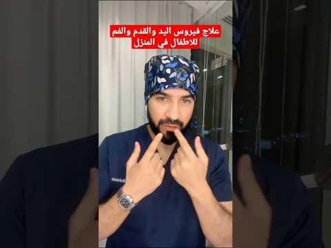 علاج فيروس اليد والقدم والفم في المنزل