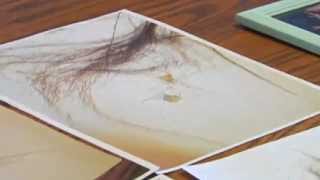 Bigfoot Hit By Trailer, Skin and Hair Samples Saved!
