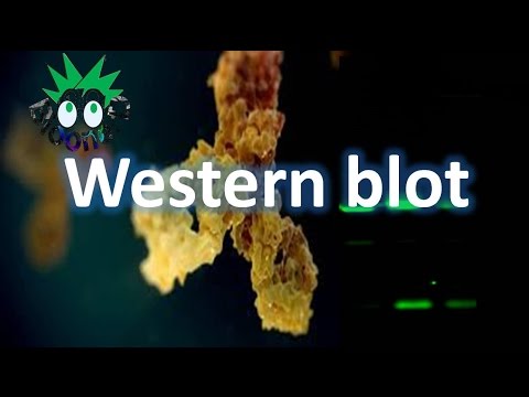 Western blot-Imuno blot