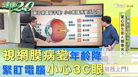 視網膜病變年齡降 攏是緊盯電腦惹得禍？ 健康2.0 - 天天要聞