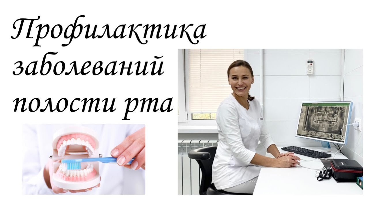 Профилактика заболеваний полости рта. Стоматолог Островская Виктория Федоровна