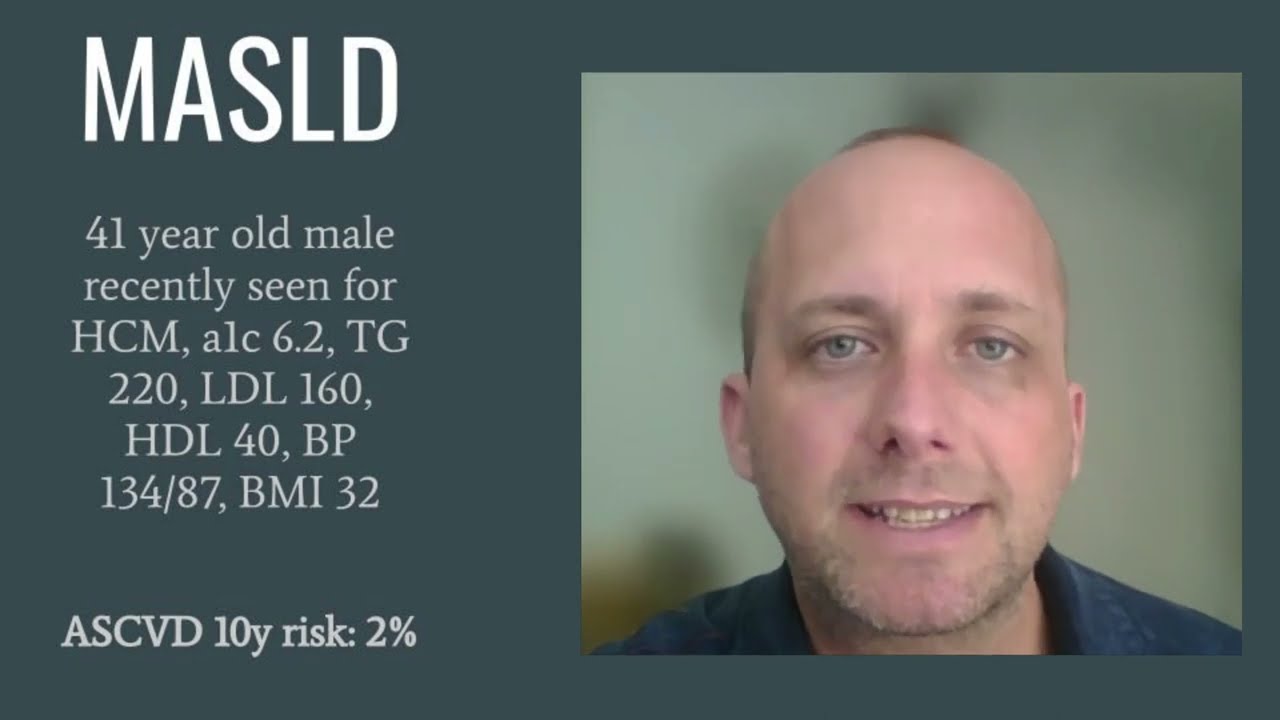 Screening for MASLD (NAFLD, NASH, MASH, liver disease)