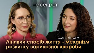 Жінки, які вилікували судинну сітку змінюють життя - НЕ СЕКРЕТ