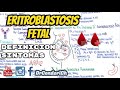 Eritroblastosis Fetal (Incompatibilidad Rh) ¿Que es?¿como sospechar ?