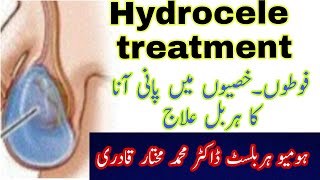 Hydrocele treatment | hydrocele ka ilaj by Qanoon Mufrad Aza in urdu /hindi Dr Muhammad Mukhtar