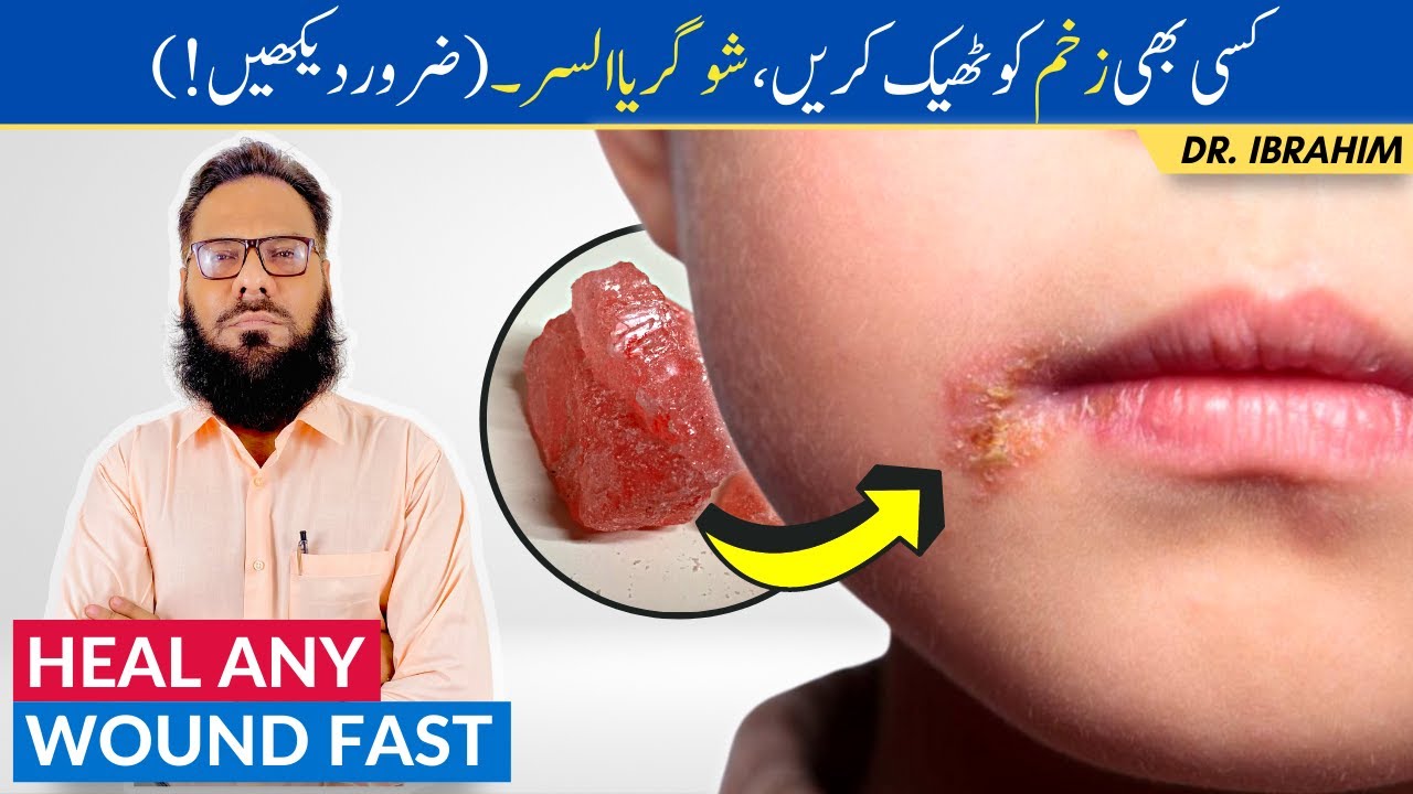 Surkh Phitkari Ke Fawaid Zakham Ka Ilaj Heal Chronic Wounds With