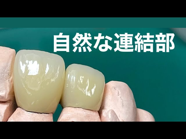 Beginner dental technician] Correcting the shape of the connecting