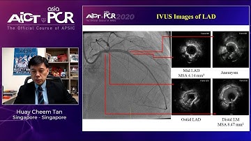 Optimise complex PCI outcomes through innovative technologies - AICT-AsiaPCR 2020