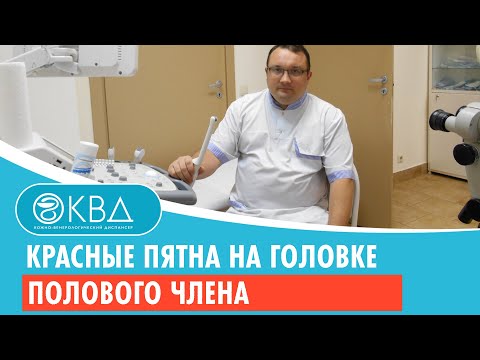 Красные пятна на головке полового члена