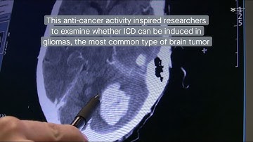 Carbonic anhydrase IX inhibitor S4 triggers immunogenic cell death in gliomas