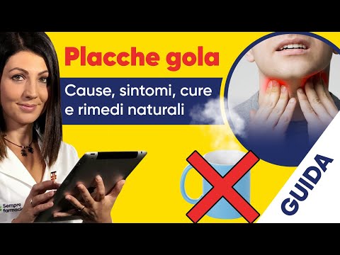 Video: 3 modi per diagnosticare la tonsillite