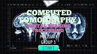 MIP 21003 DIGITAL IMAGING PROCESSING OF CT 