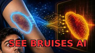 BruNet for Bruise Segmentation: Cross-Domain AI