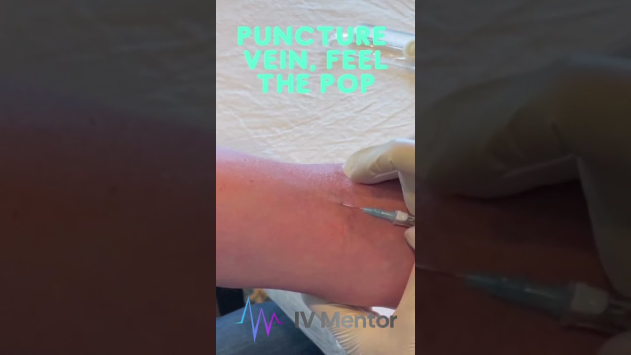IV Insertion In 6 Easy Steps