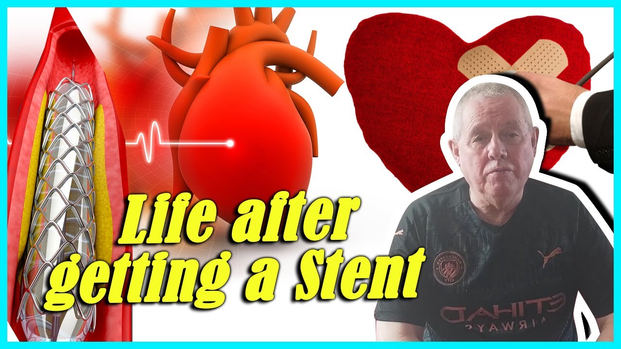 Coronary Stents What You Need To Know About Your Stent YouTube