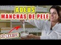 Use para CLAREAR qualquer MANCHA DE PELE ! Melasma , Manchas nas Axilas , Virilhas